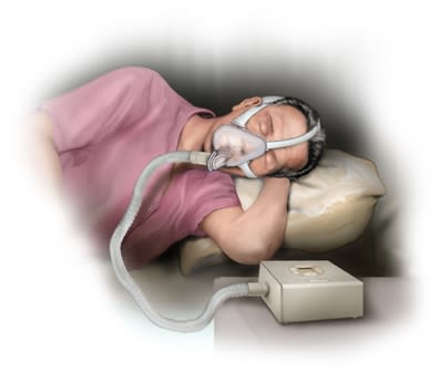 Sleep monitor apnea