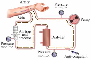 Dialysis pump