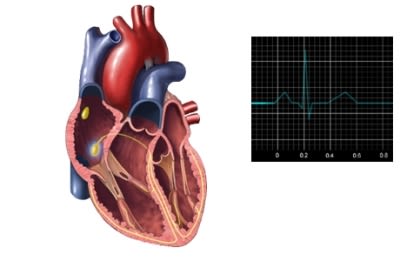 Heart EKG