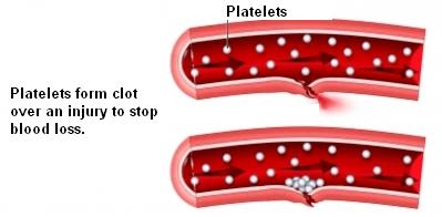 blood clot platelet
