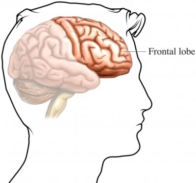 Frontal lobe