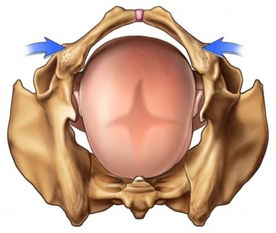 Pelvis birth