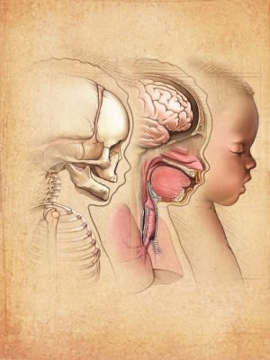 Infant Brain and skull