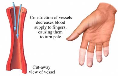 Low blood flwo to fingers, vasoconstriction