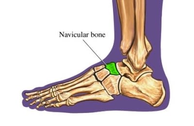 si55550253_97870_1_Navicular_Bone_Foot