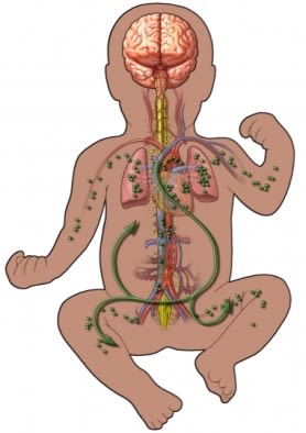infant sepsis